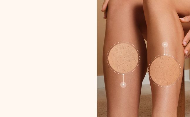 Braun Silk·épil 7, Epilátor 7-000, Bílý/Růžový