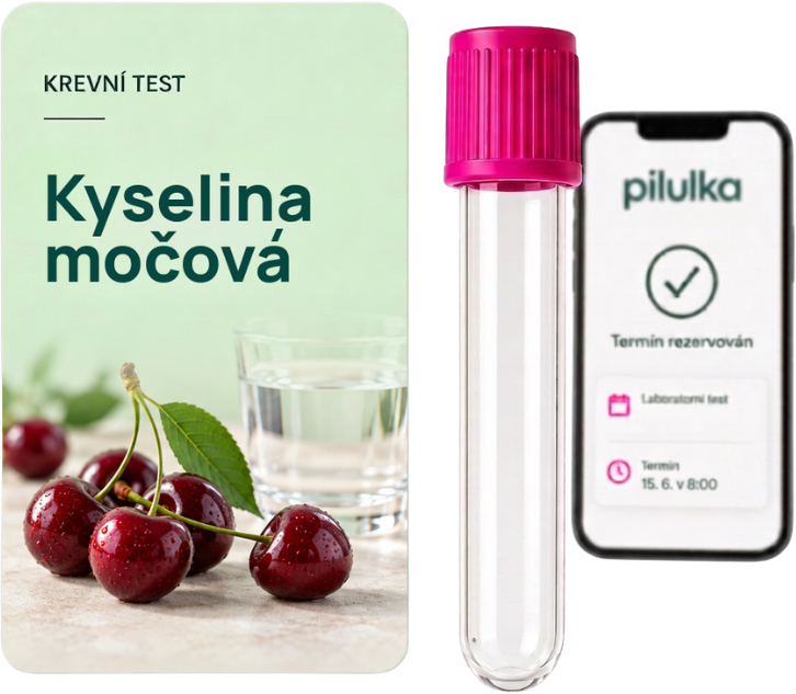 Unilabs Krevní test na kyselinu močovou