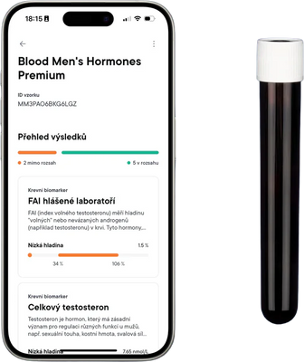 Macromo Mužské hormony Krevní test