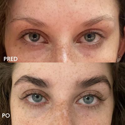 Facederma HairPlus MAX sérum pro růst řas a obočí 4.5 ml