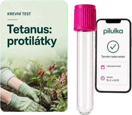 Unilabs Tetanus: hladina protilátek