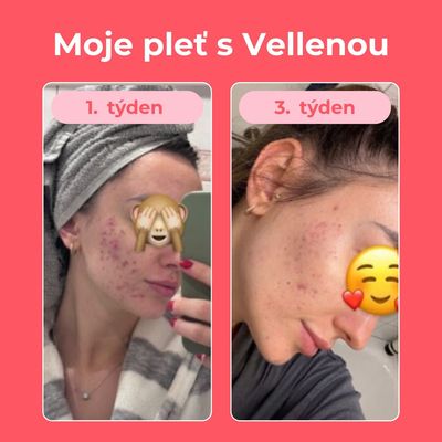 Vellena Ženské zdraví nápoj příchuť Broskev 30 sáčků