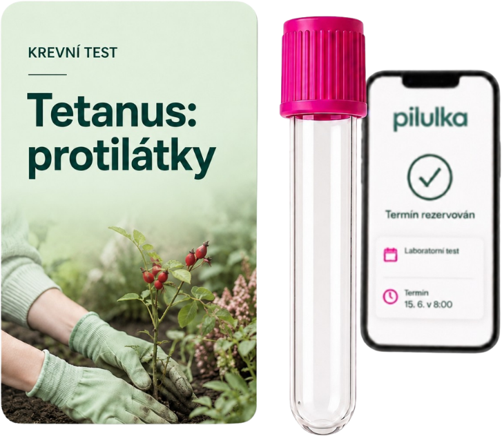 Unilabs Tetanus: hladina protilátek