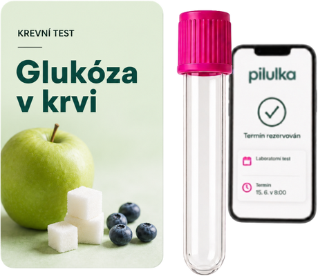 Unilabs Glukóza v krvi