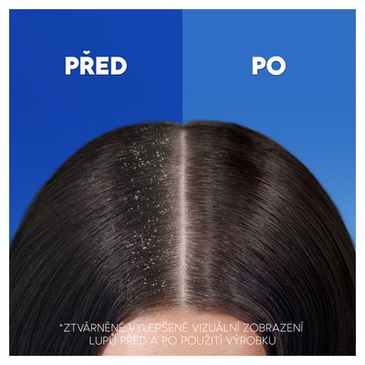 Head & Shoulders Citrus Fresh Šampón 400 ml