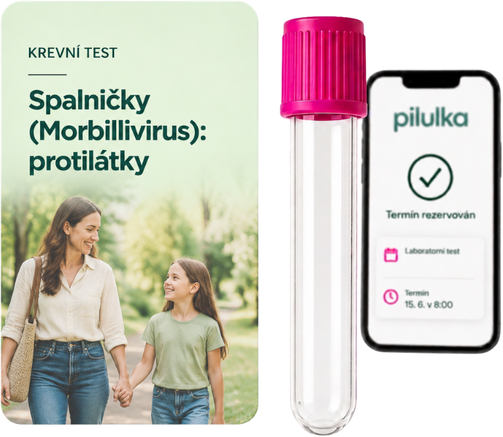 Unilabs Spalničky (Morbillivirus): hladina protilátek