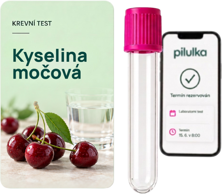 Unilabs Krevní test na kyselinu močovou