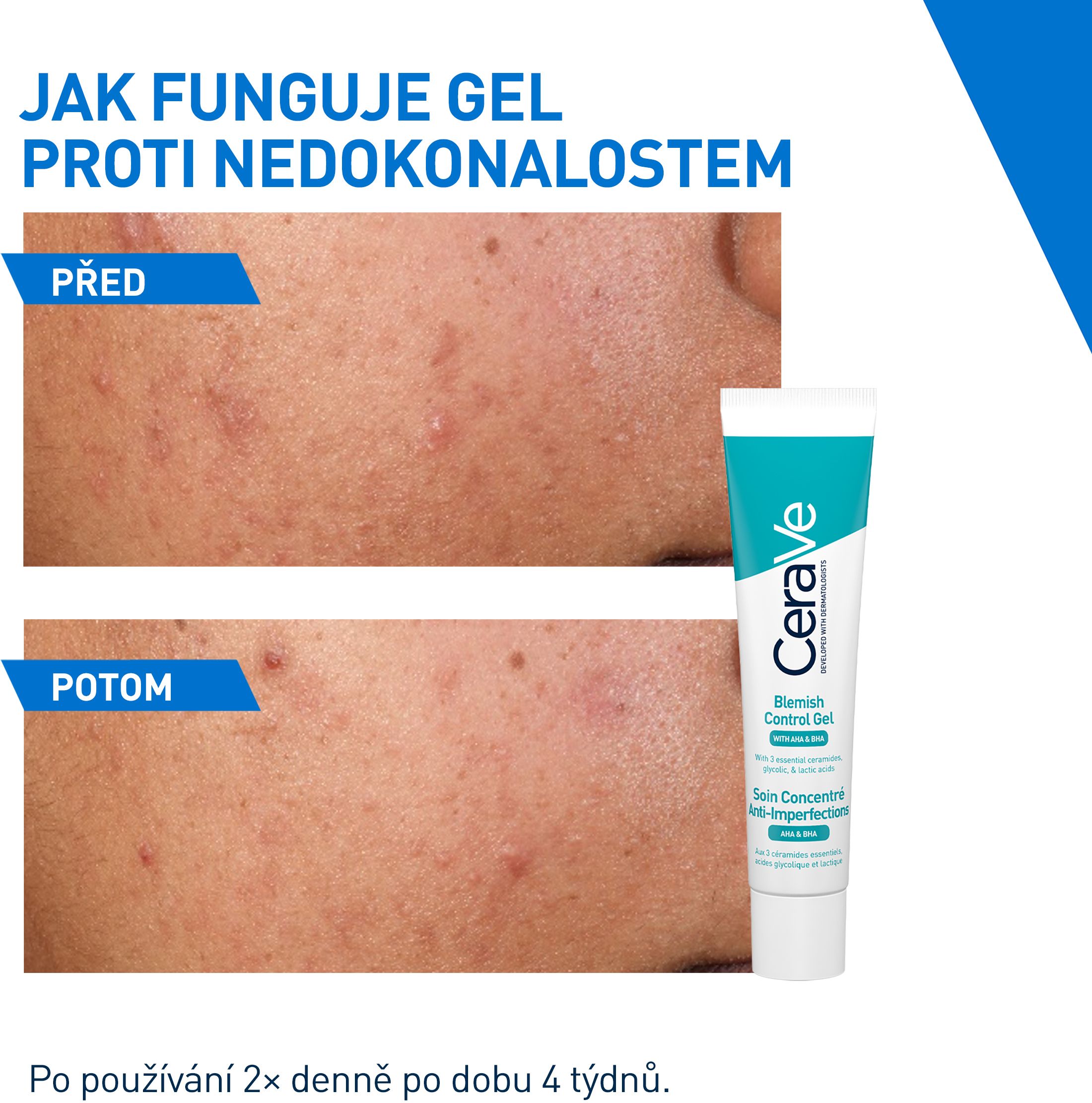 CeraVe Gel proti nedokonalostem s AHA a BHA 40 ml
