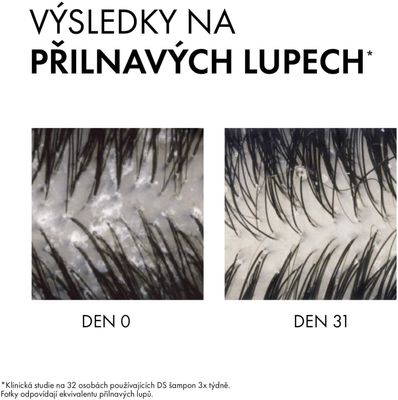 Vichy Dercos šampon a kondicionér na lupy 2v1 200 ml