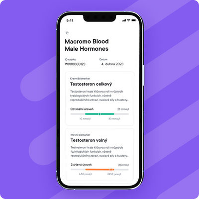 Macromo krevní test Mužské hormony