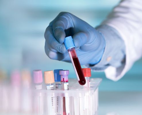 Unilabs Krevní test na cholesterol