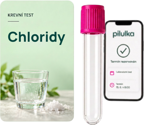 Unilabs Krevní test na chloridy