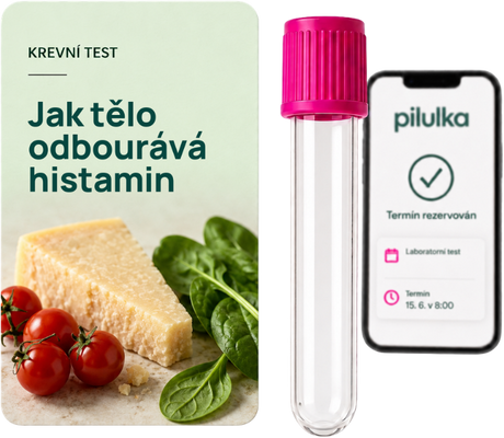 Unilabs Jak tělo odbourává histamin (DAO)