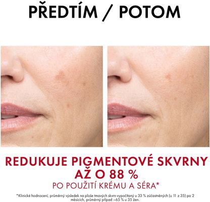 Vichy Liftactiv B3 Anti-Dark Spot krém SPF50 proti pigmentovým skvrnám a vráskám 50 ml