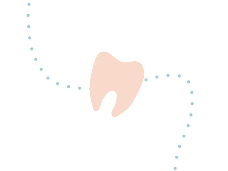 pouzivani dentalni nite