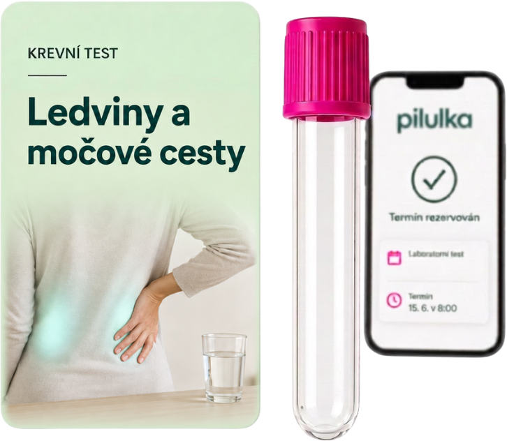 Unilabs Kontrola ledvin a močových cest