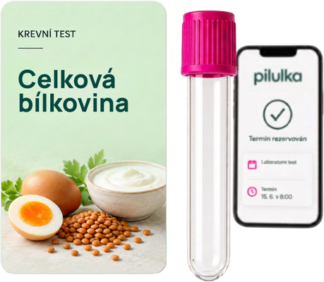Unilabs Krevní test na celkovou bílkovinu