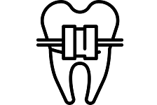 ortodoncie rovnátka