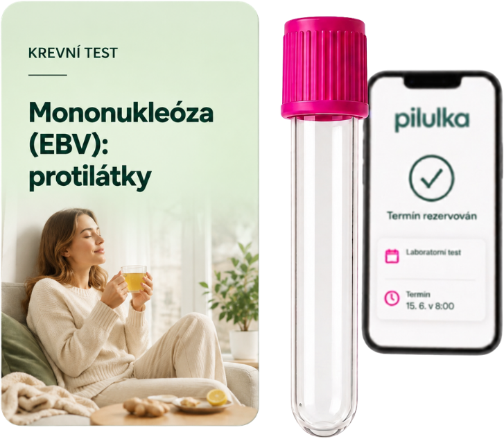 Unilabs Mononukleóza (EBV): hladina protilátek