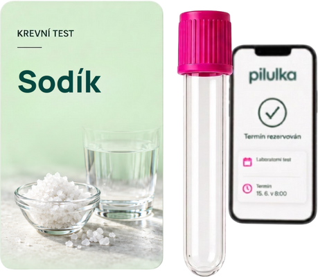 Unilabs Krevní test na sodík (Natrium, Na)