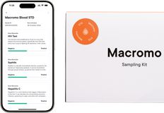 Macromo krevní test Pohlavně přenosné nemoci