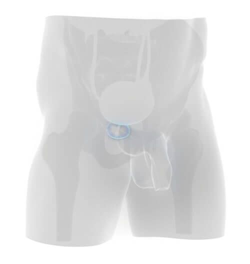 prostenal, zväčšená prostata
