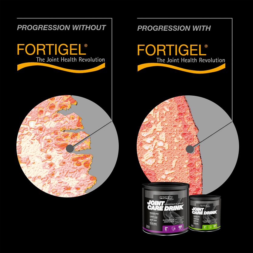 Fortigel