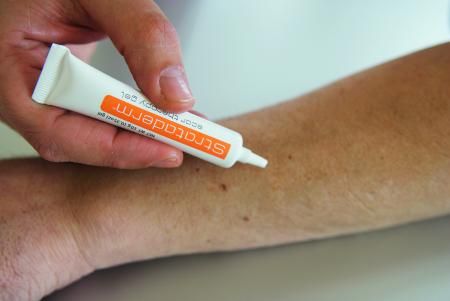 Strataderm gel 5 g
