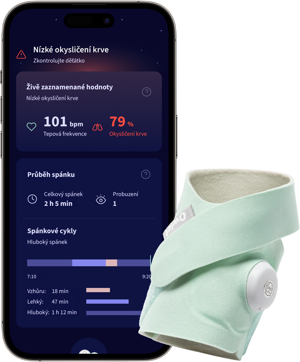 Owlet Inteligentní ponožka Dream Sock - modrozelená