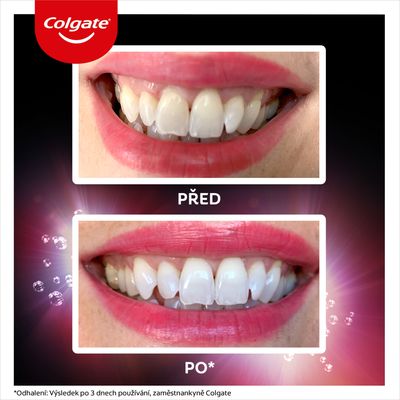 Colgate Max White Ultra Active Foam, bělicí zubní pasta 50 ml