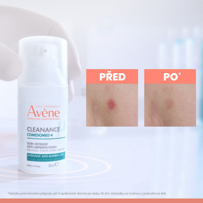 Avène Cleanance ComedoMed péče 30 ml