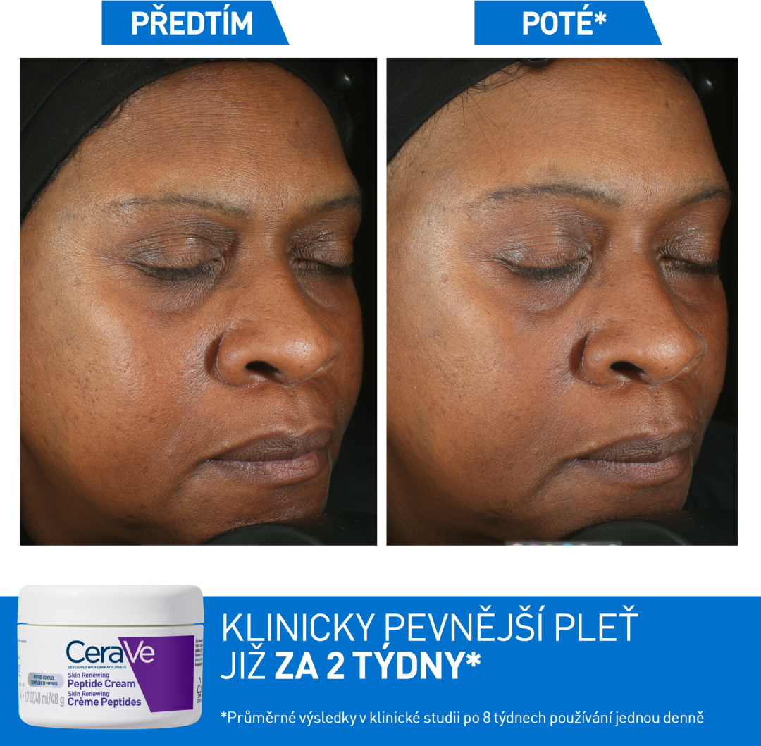 CeraVe peptidový krém pro obnovu pleti s 3 esenciálními ceramidy a niacinamidem 48 ml