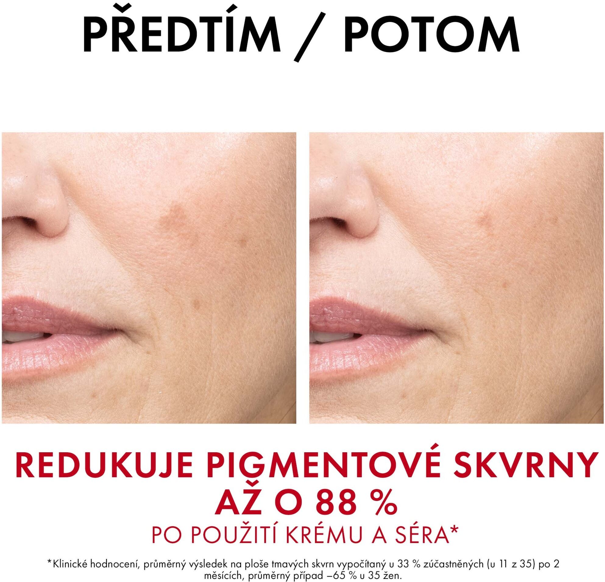 Vichy Liftactiv B3 Anti-Dark Spot krém SPF50 proti pigmentovým skvrnám a vráskám 50 ml