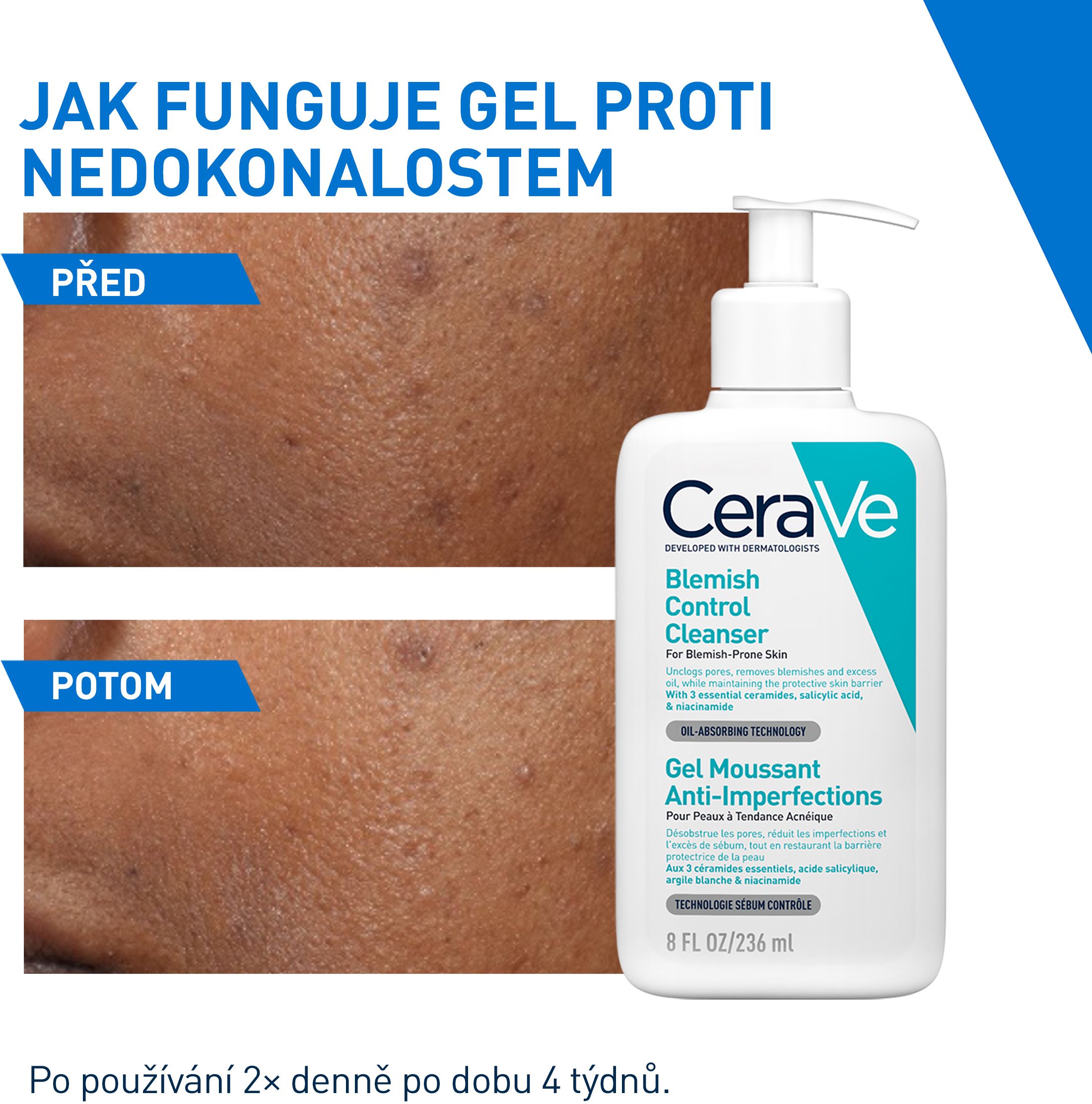 CeraVe Čisticí gel proti nedokonalostem 236 ml