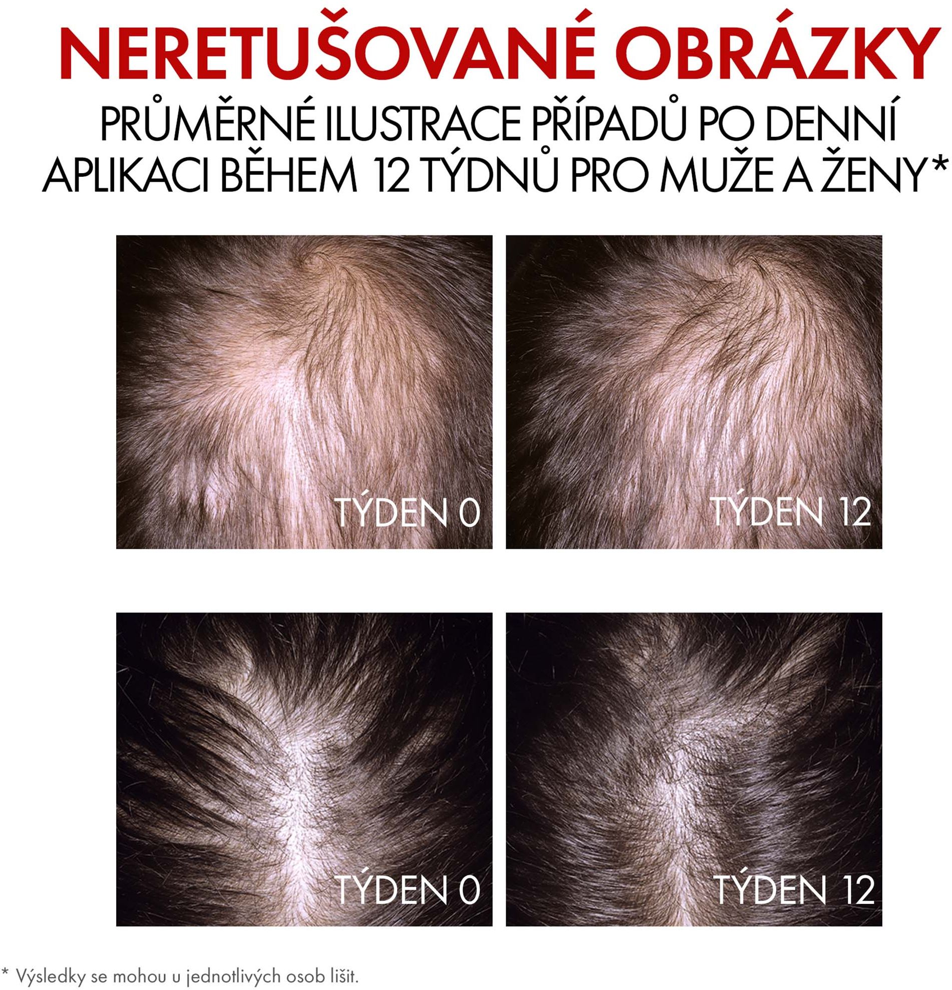 Vichy DERCOS Aminexil Clinical R.E.G.E.N. Booster sérum proti vypadávání vlasů 90 ml