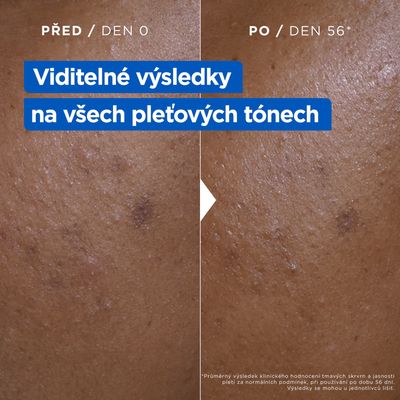 Mixa Niacinamide Bright hydratační krém proti tmavým skvrnám 400 ml