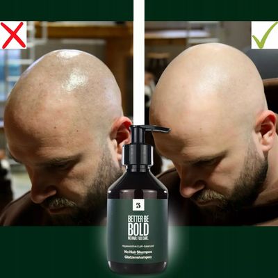 Better be bold No Hair Shampoo, Šampon pro může bez vlasů 200 ml