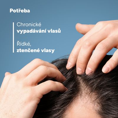 Ducray Neoptide Expert sérum proti vypadávání vlasů 2 x 50 ml