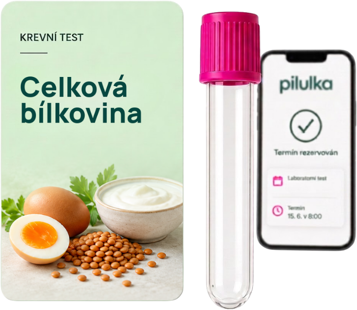 Unilabs Krevní test na celkovou bílkovinu