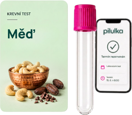 Unilabs Krevní test na měď (Cuprum, Cu)