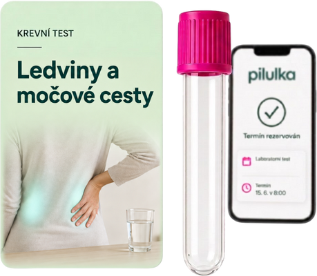 Unilabs Kontrola ledvin a močových cest