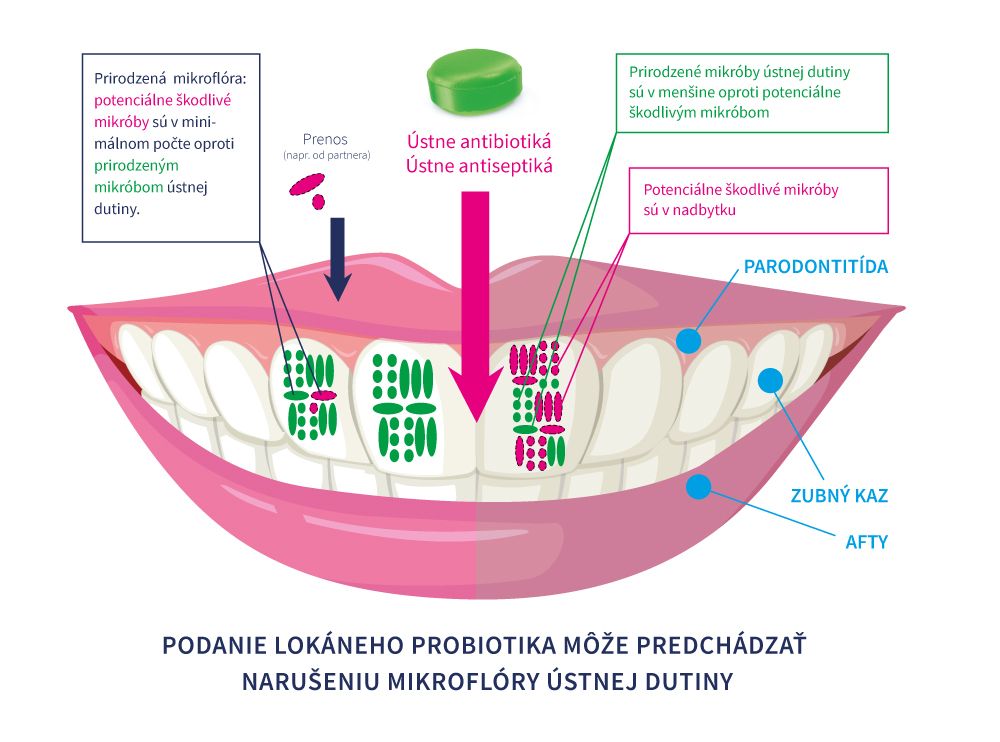 Probiotiká a ústna mikroflóra