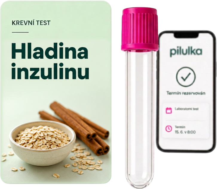 Unilabs Hladina inzulinu