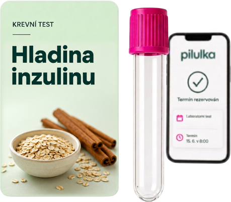 Unilabs Hladina inzulinu