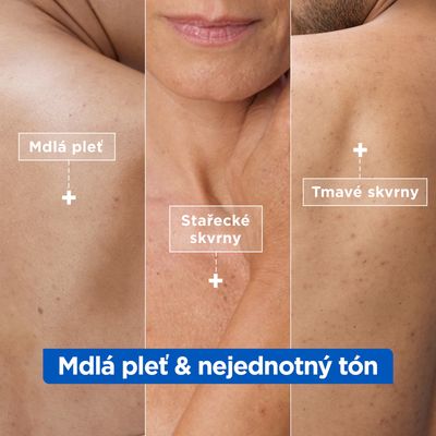 Mixa Niacinamide Bright hydratační krém proti tmavým skvrnám 400 ml