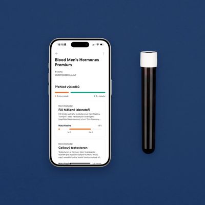 Macromo Mužské hormony Krevní test