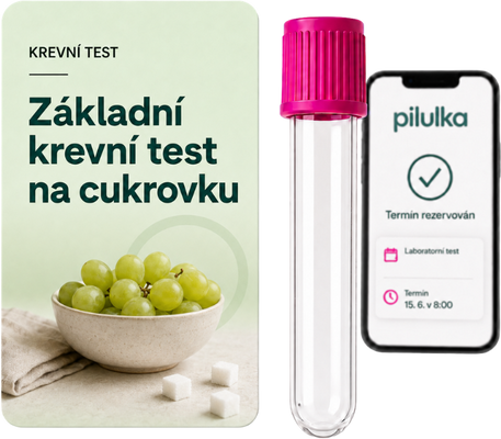 Unilabs Základní krevní test na cukrovku