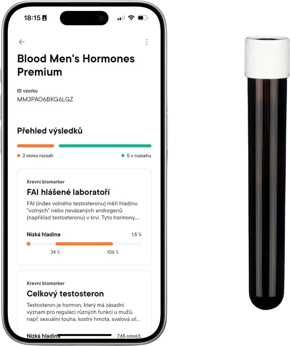 Macromo Mužské hormony Krevní test