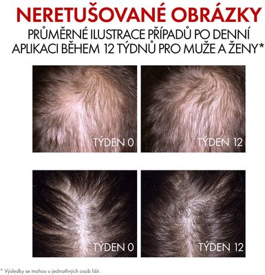 Vichy DERCOS Aminexil Clinical R.E.G.E.N. Booster sérum proti vypadávání vlasů 90 ml