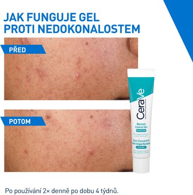 CeraVe Gel proti nedokonalostem s AHA a BHA 40 ml